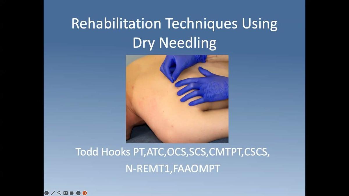 Dry Needling