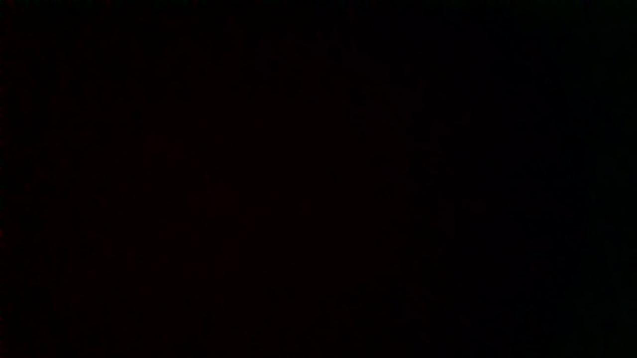 How was your post operative experience?