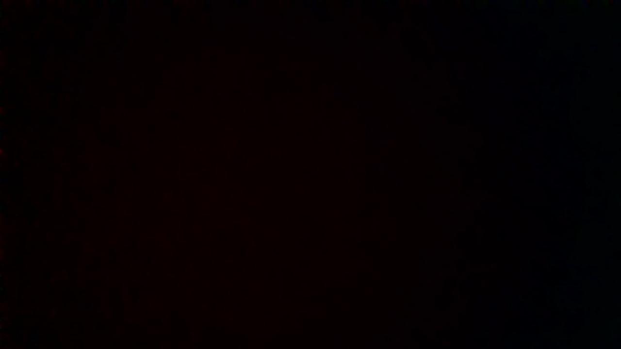 How was your post operative experience?