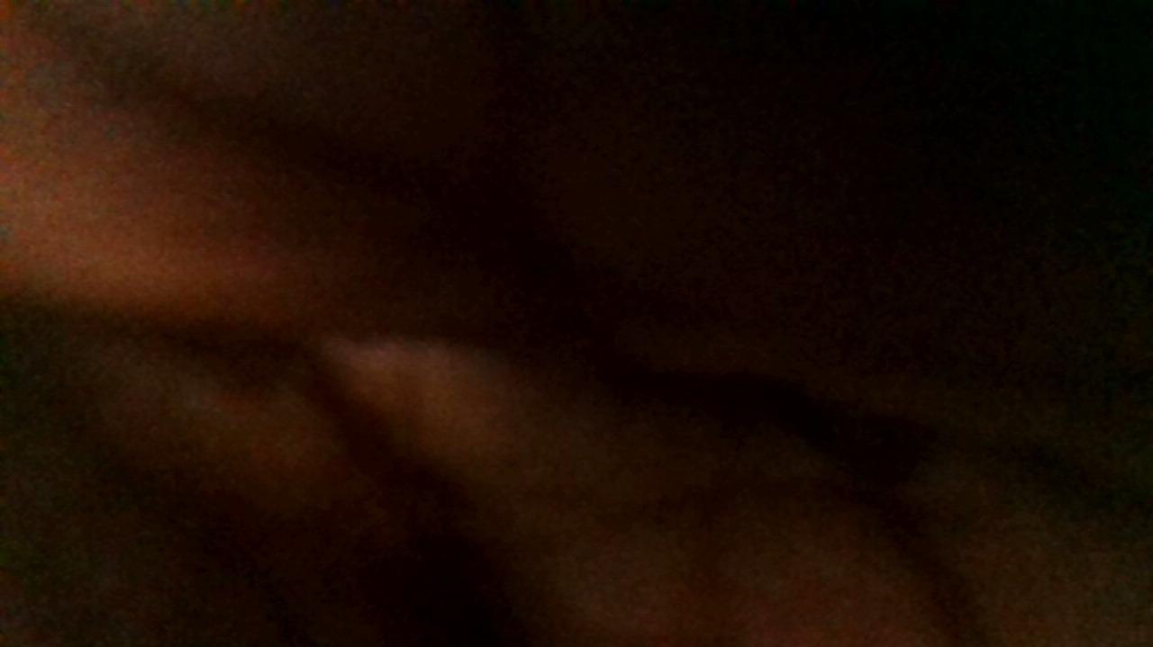 How was your post operative experience?