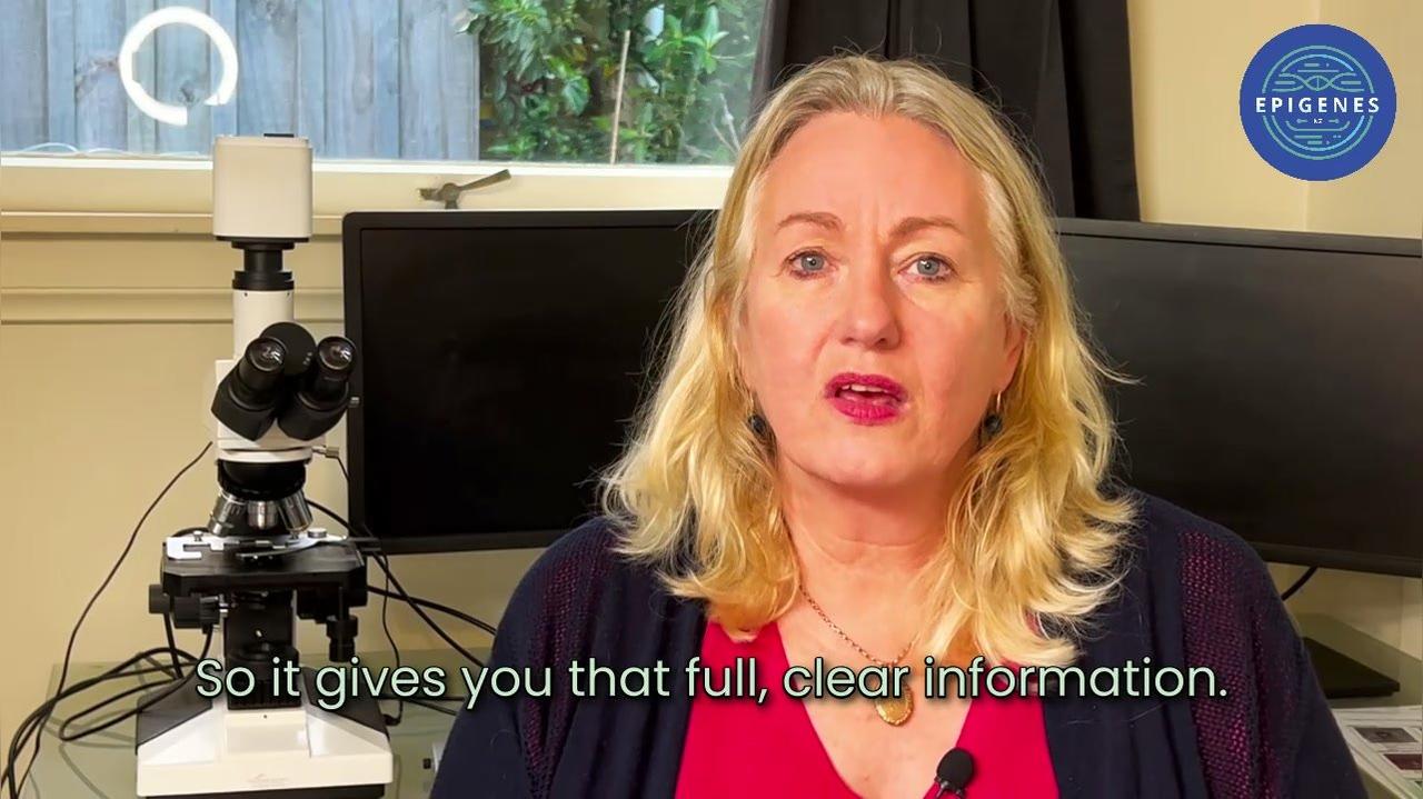 0-. What is the Epigenes report