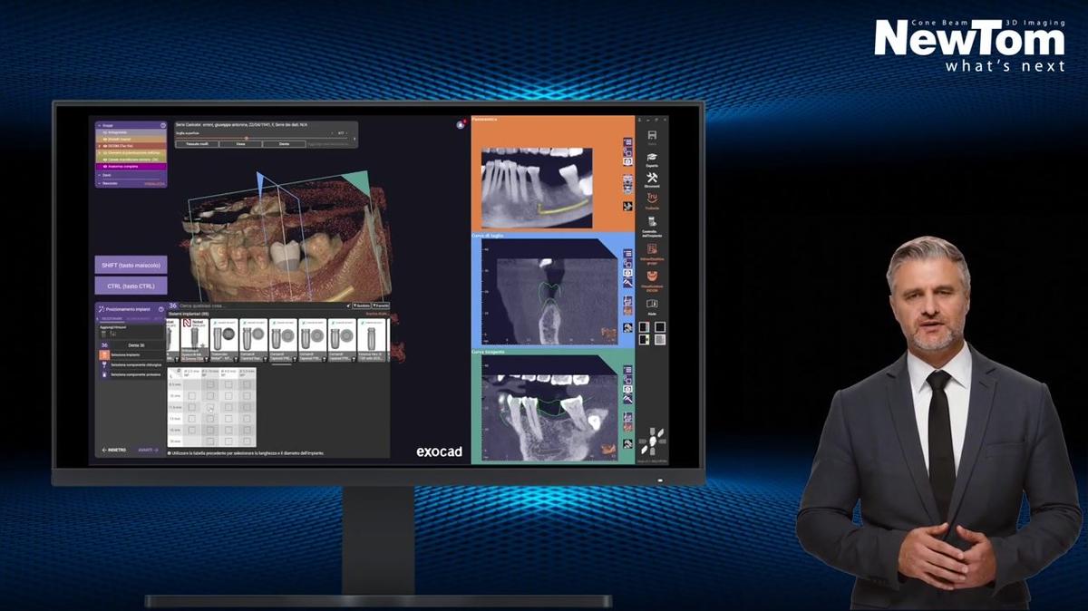 Implant Planning with exocad