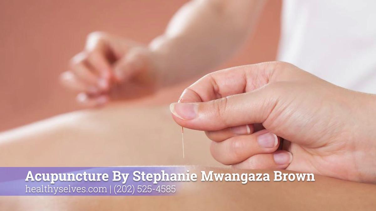 Acupuncture in Silver Spring MD, Acupuncture By Stephanie Mwangaza Brown