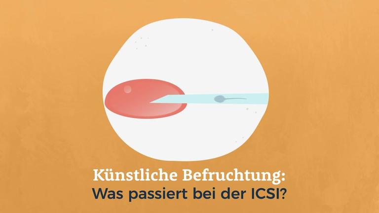 Künstliche Befruchtung: Was passiert bei der ICSI?