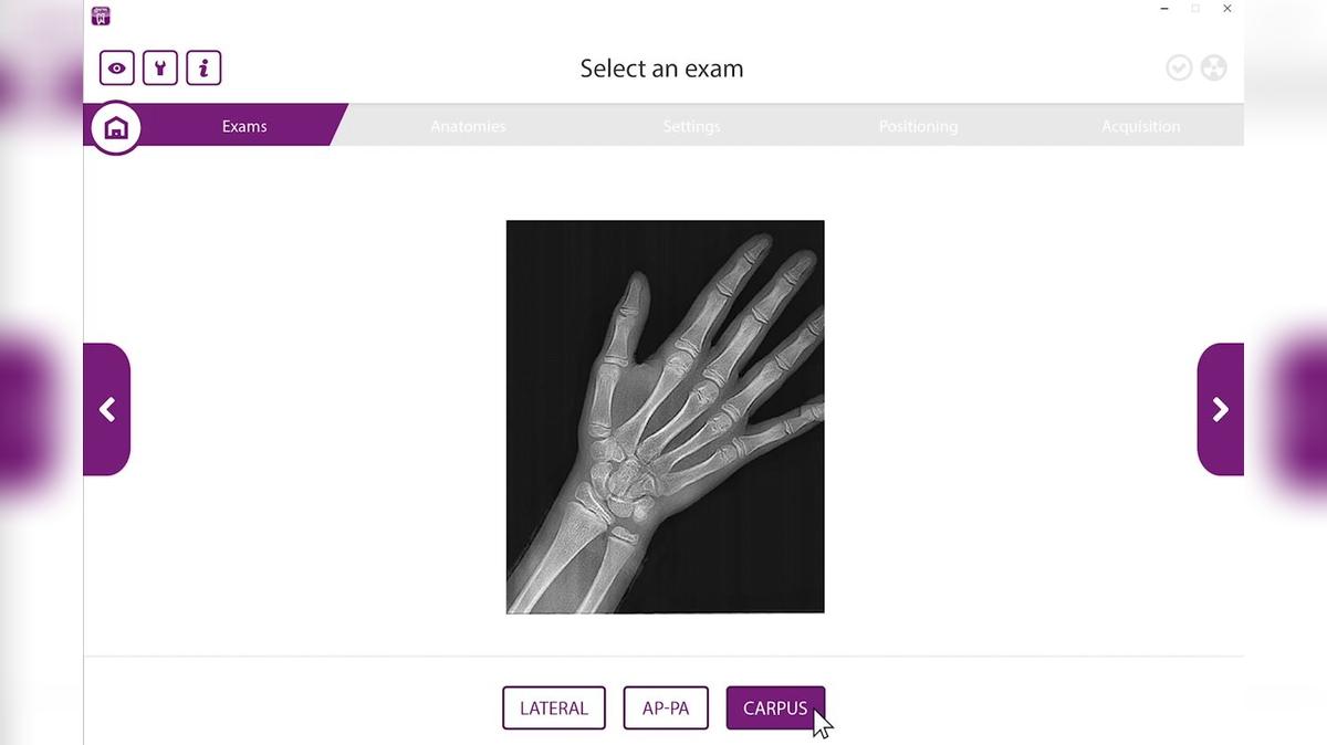 Hyperion X9 PRO Carpal Acquisition