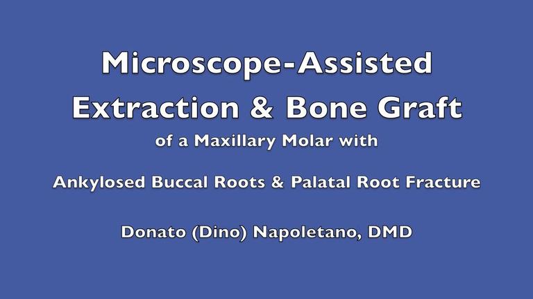 Microscope-Assisted Surgical Extraction and Bone Graft Application 