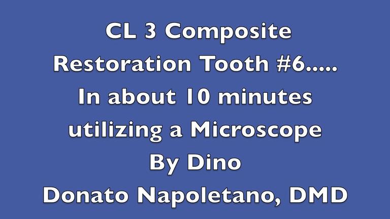 Microscope-Assisted Composite Filling Preparation &amp; Restoration