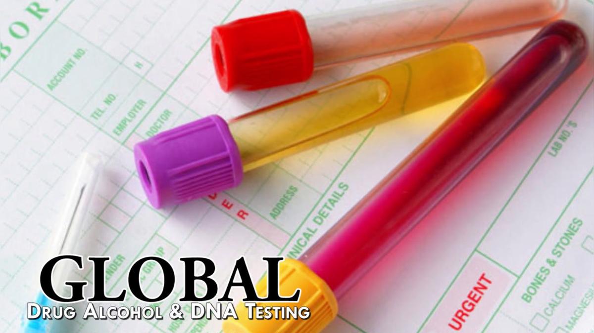 Drug Testing in Oakland CA, Global Drug Alcohol & DNA Testing