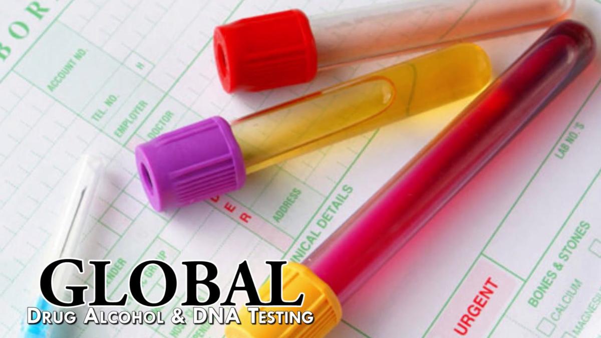 Drug Testing in Oakland CA, Global Drug Alcohol & DNA Testing