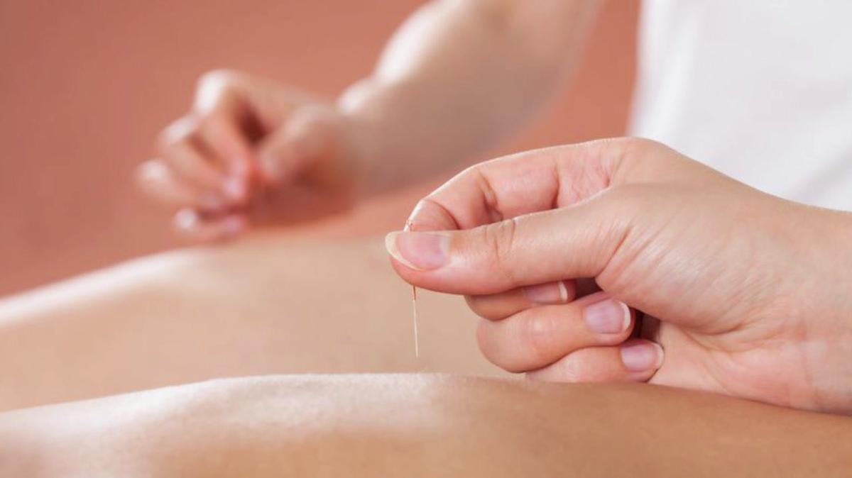 Acupuncture in Elgin IL, Roessler Acupuncture Clinic