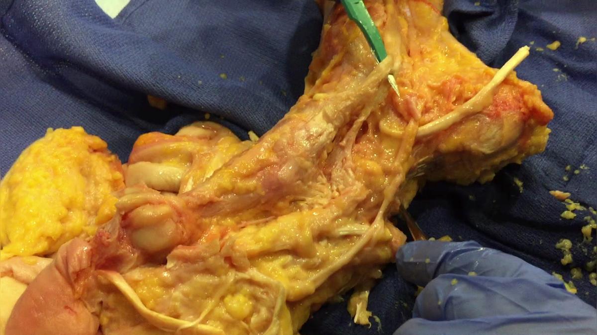 2018.AF.2.Basic.Foot Ankle Dissection 3 by Jason Markle DO.MOV