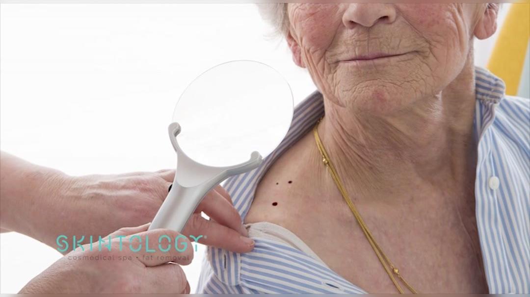 Medical Spa and Laser Hair Removal in New York NY, Skintology Medical Spa - Laser Hair Removal