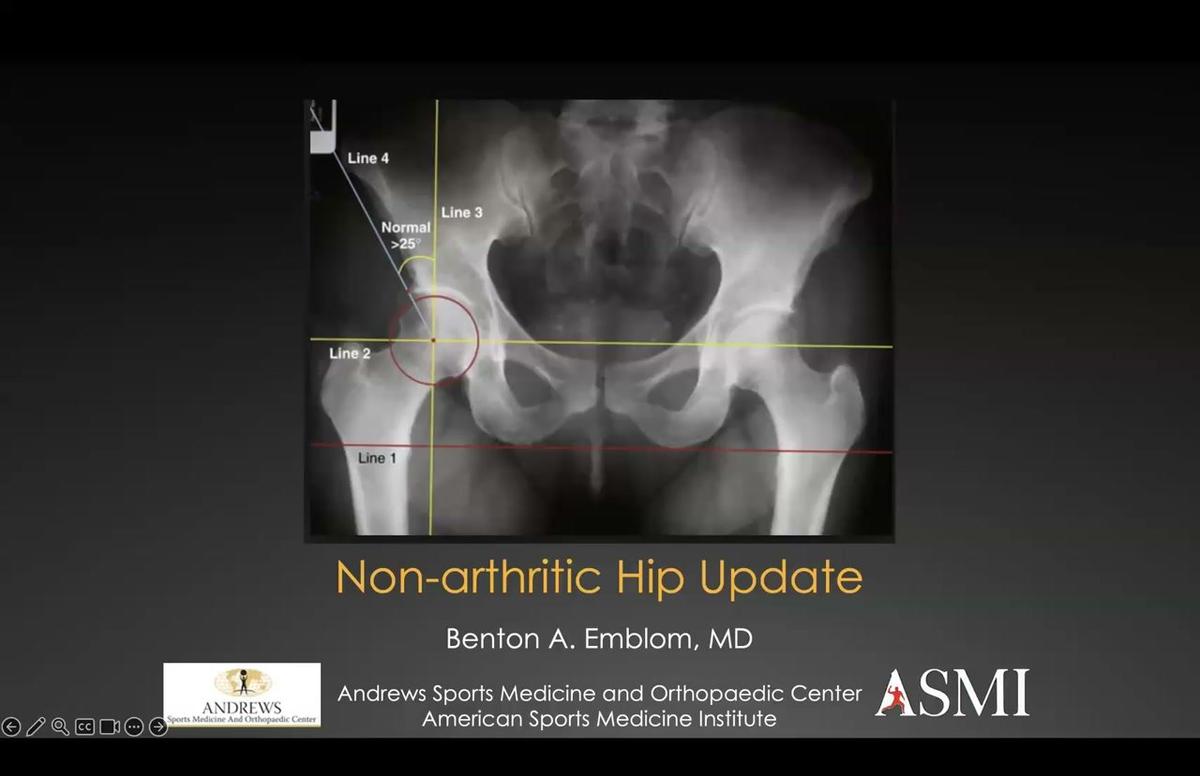 Non-Arthritic Hip Update