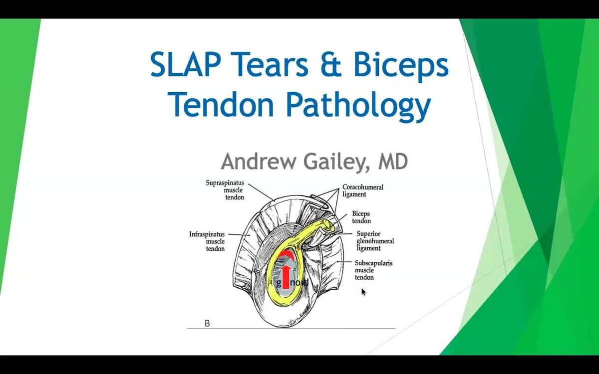 SLAP Tears &amp; Biceps Tendon Pathology