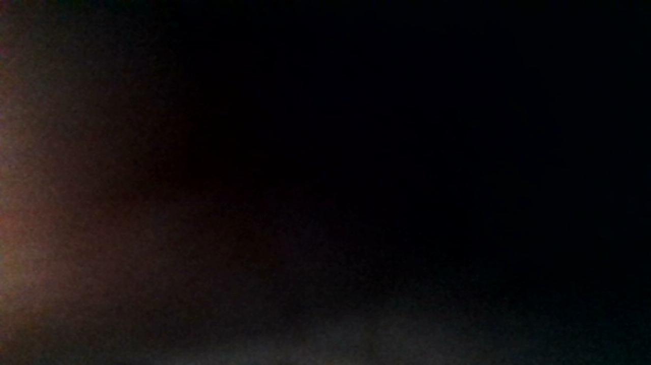 How was your post operative experience?