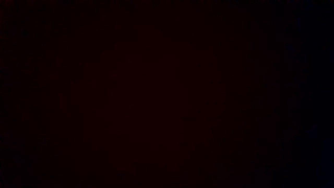 How was your post operative experience?