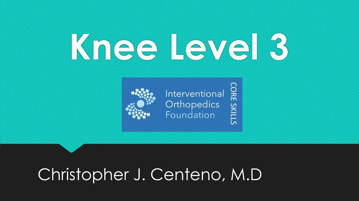 Knee Level 3 PCL under Fluoro and US.mp4