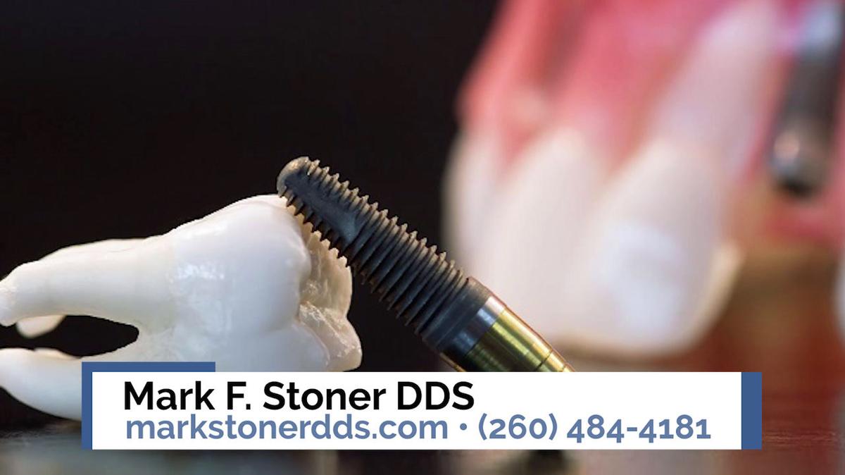 Dentist in Fort Wayne IN, Mark F. Stoner DDS