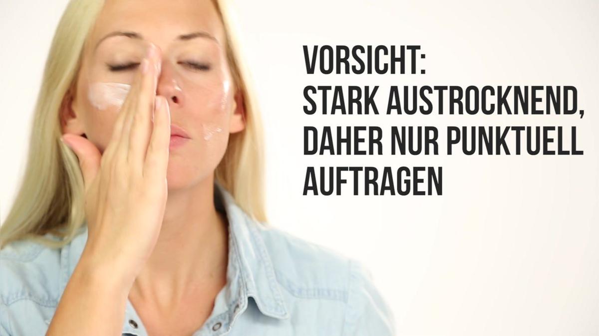 Die 5 besten Tipps gegen Pickelmale