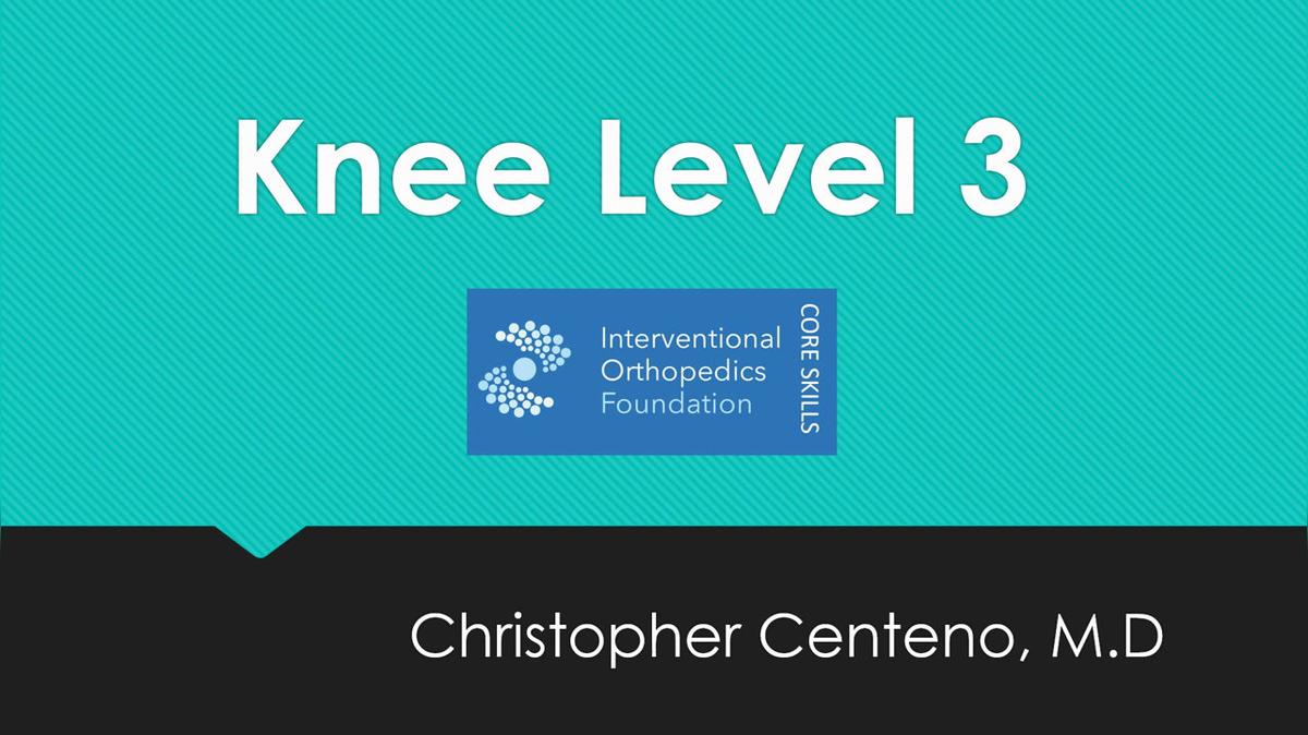 Knee Level 3 Knee Bone Aug under Fluoro.mp4