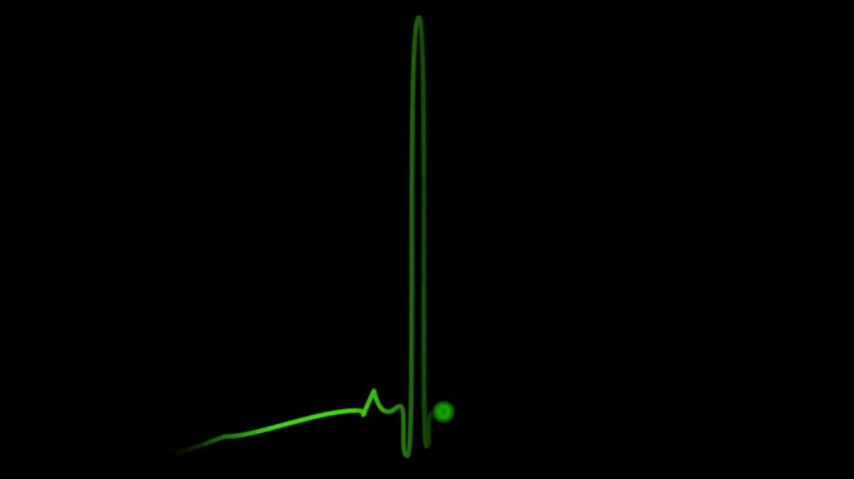 Q4W7 Heartrate