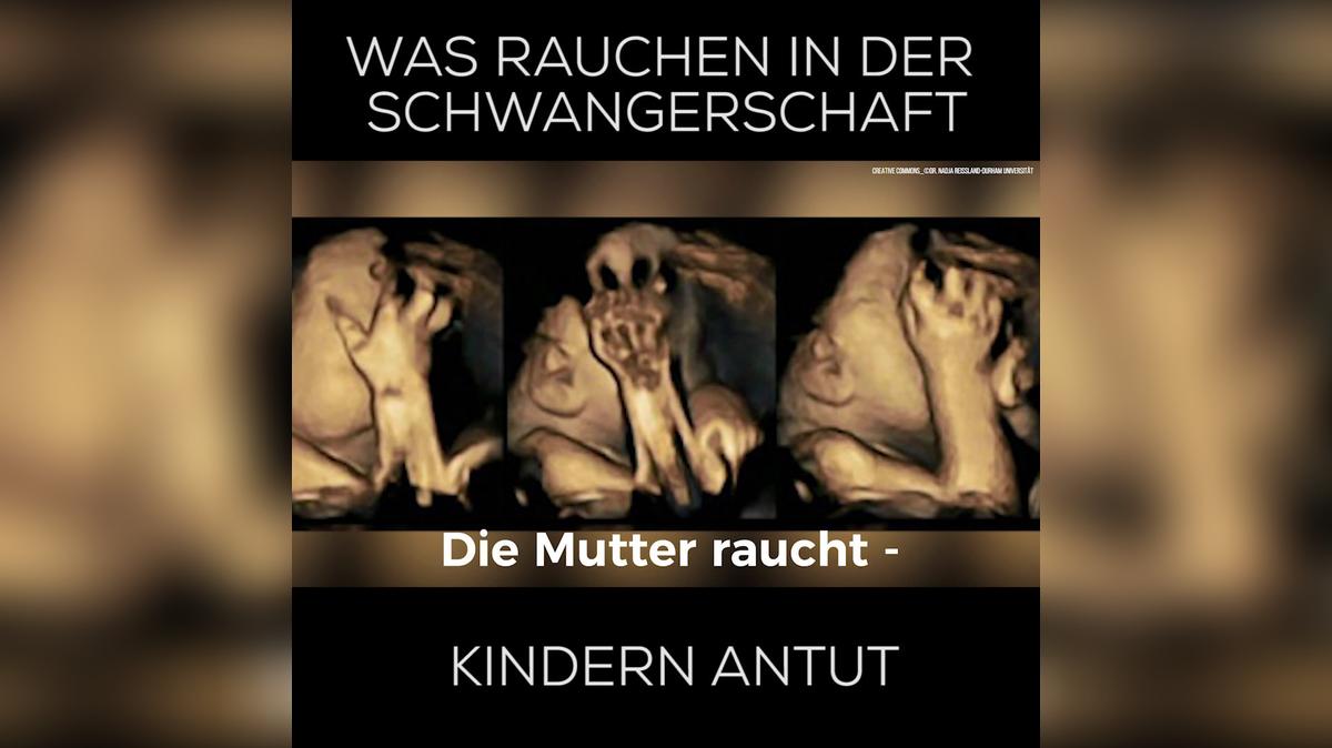 Was rauchen während der Schwangerschaft deinem Kind antut 1:1