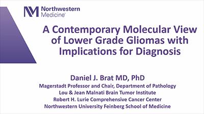 A Contemporary Molecular View of Lower Grade Gliomas with Implications for Diagnosis