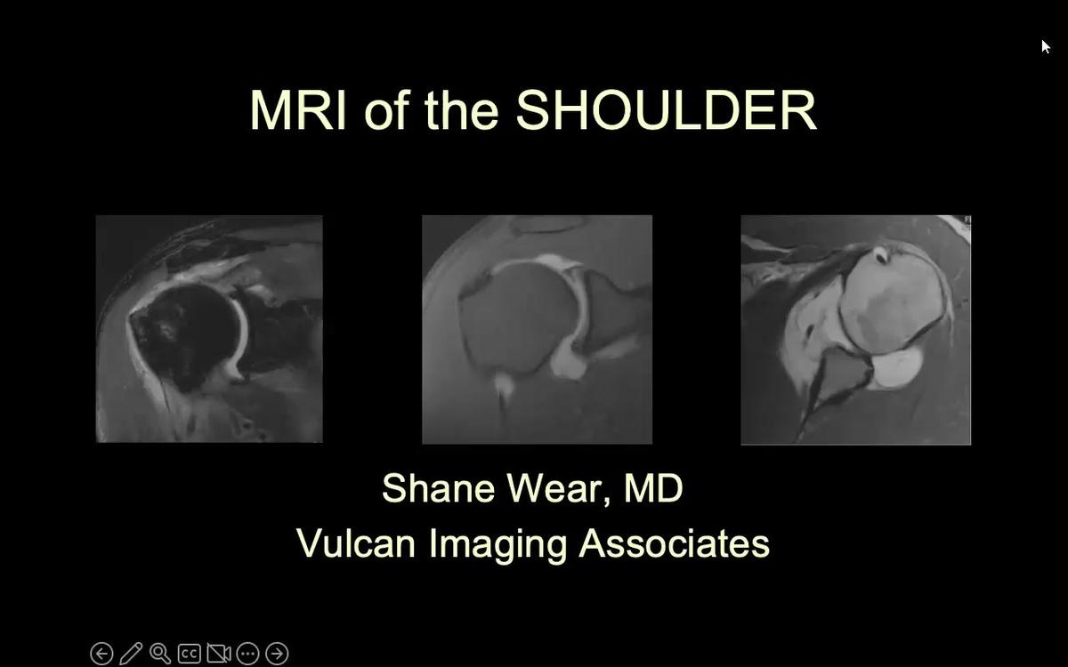 MRI of the Shoulder