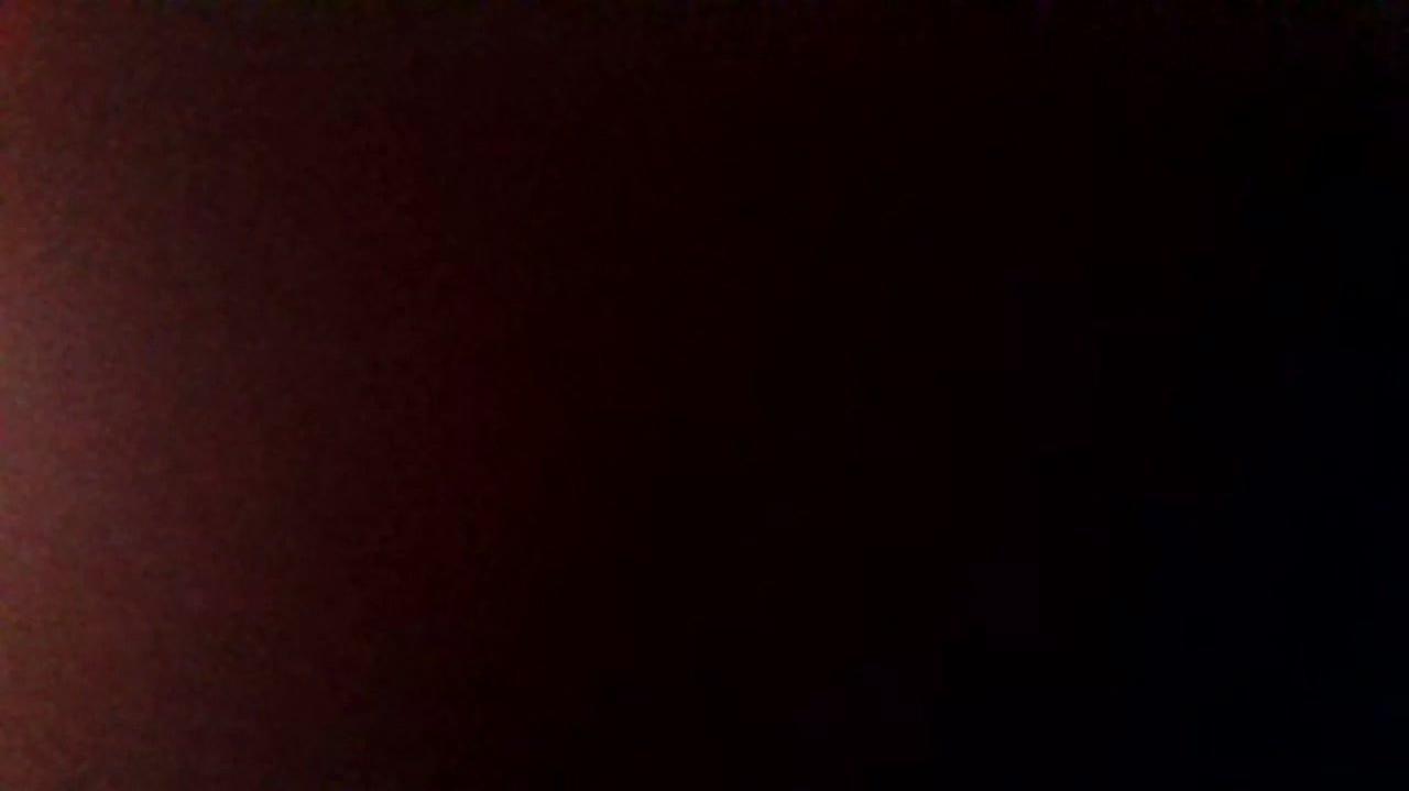 How was your post operative experience