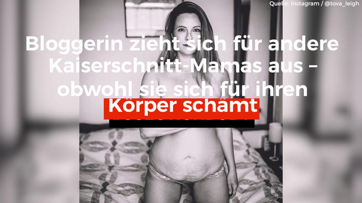 Bloggerin zieht sich für andere Kaiserschnitt - Mamas aus