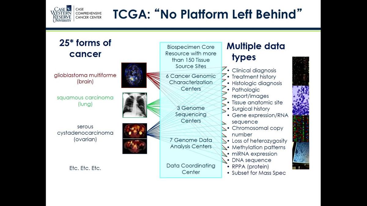 Leveraging big data to impact brain tumor research, Jill Barnholtz-Sloan