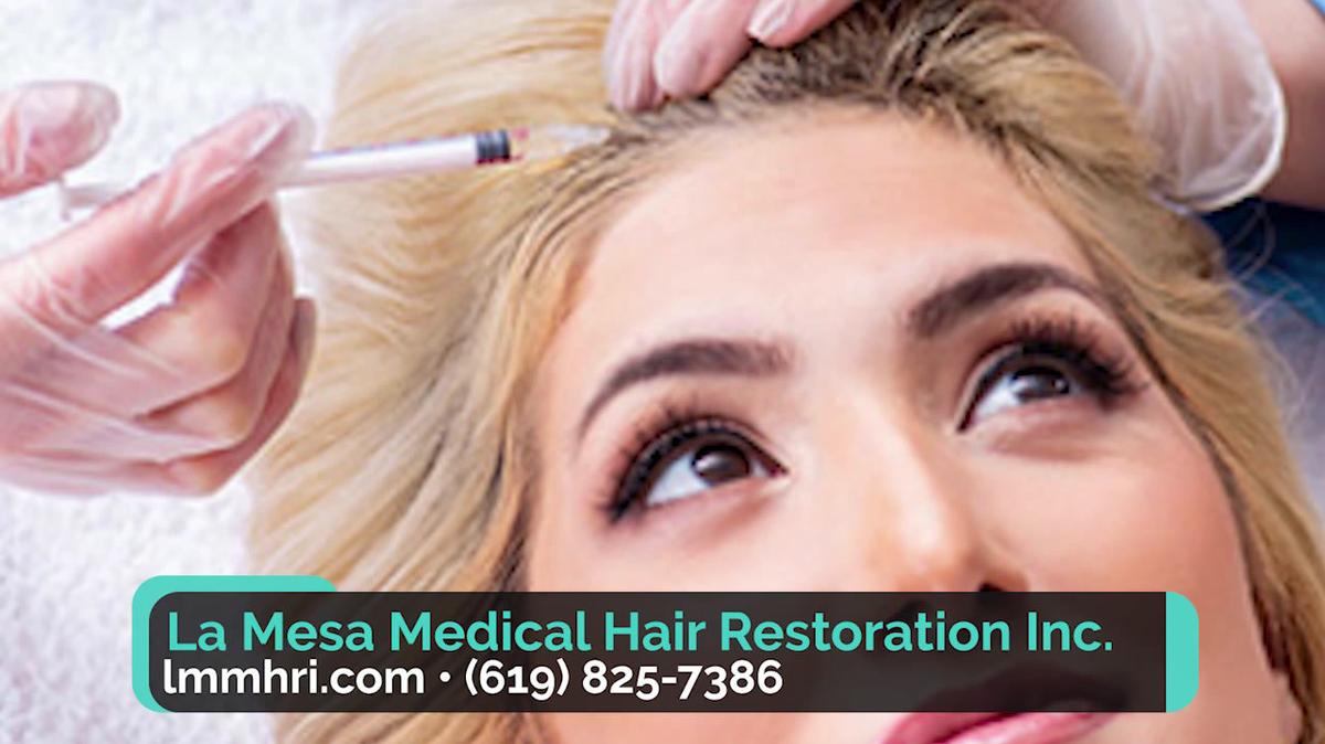 Hair Restoration in La Mesa CA, La Mesa Medical Hair Restoration Inc.