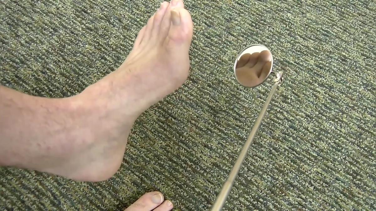 Diabetes Foot Exam