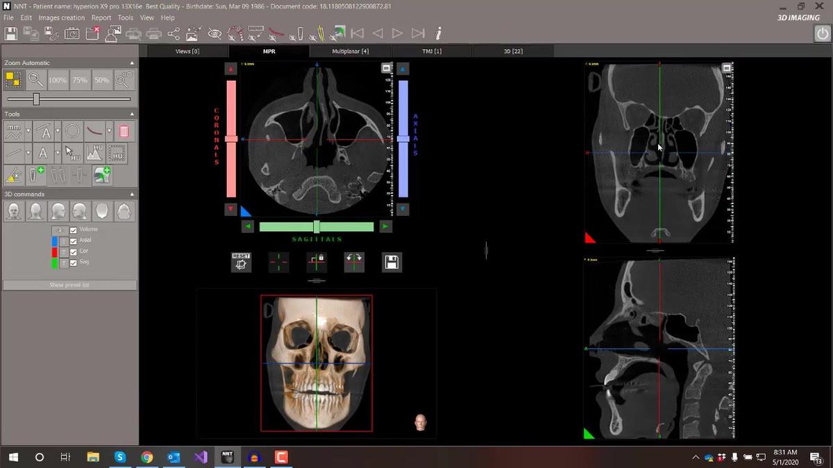 NNT 11 - Navigating the MPR Screen
