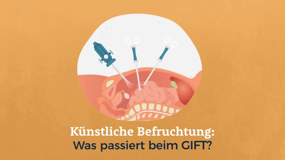Künstliche Befruchtung: Was passiert bei dem GIFT?