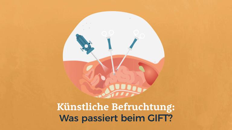 Künstliche Befruchtung: Was passiert bei dem GIFT?