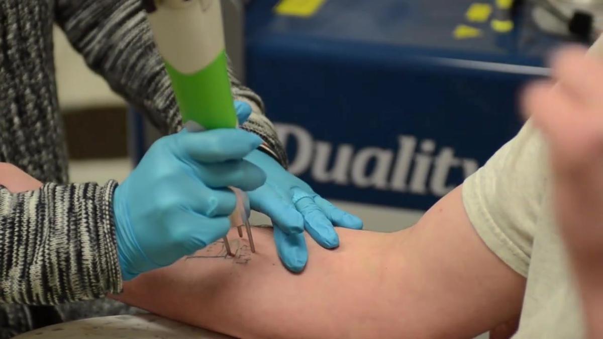 Tattoo Removal Clinic at Texas Juvenile Justice Department