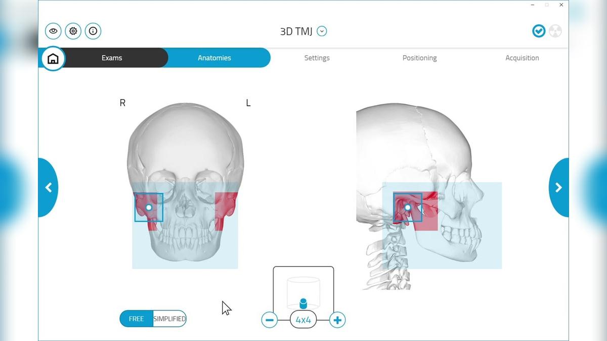 GiANO HR 3D TMJ Scan