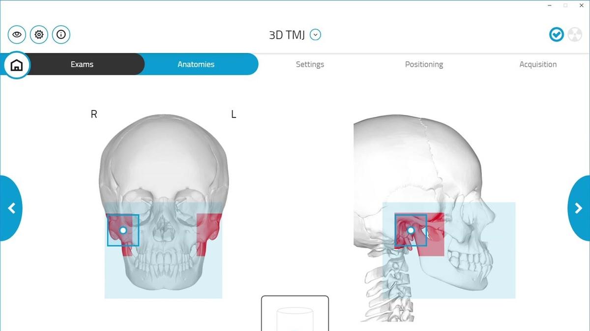 GiANO HR 3D TMJ Scan