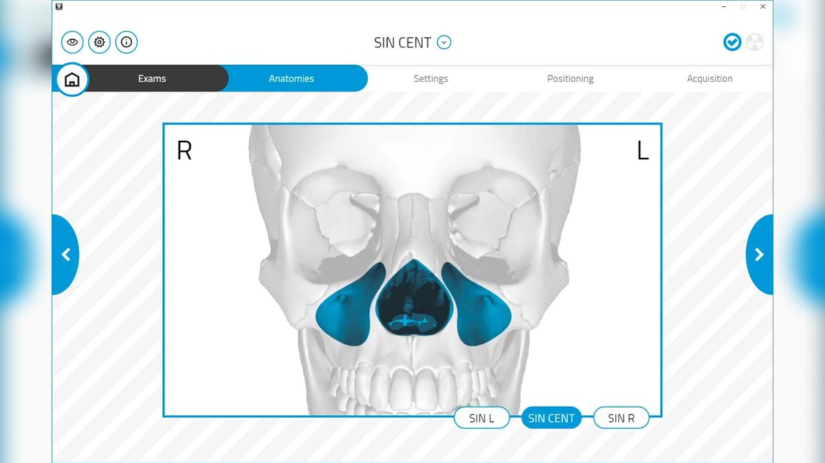 GO Ceph Ready Sinus