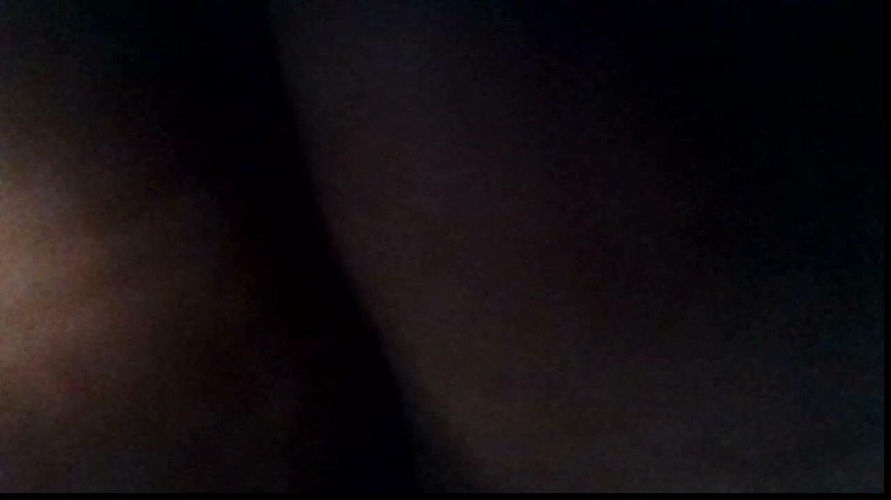 How was your post operative experience?