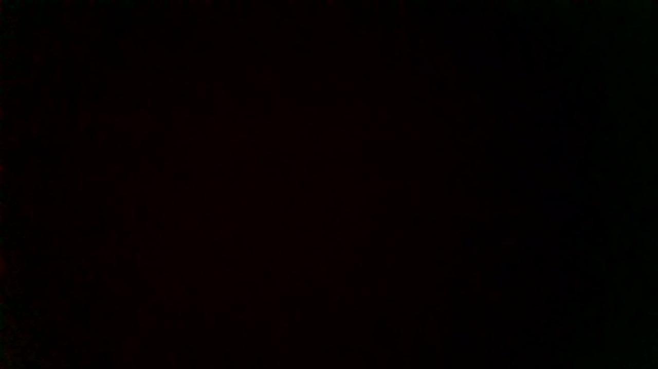 How was your post operative experience?