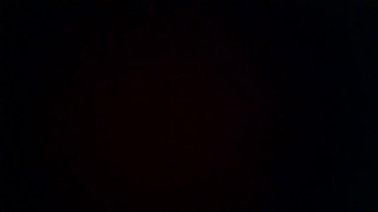 How was your post operative experience?