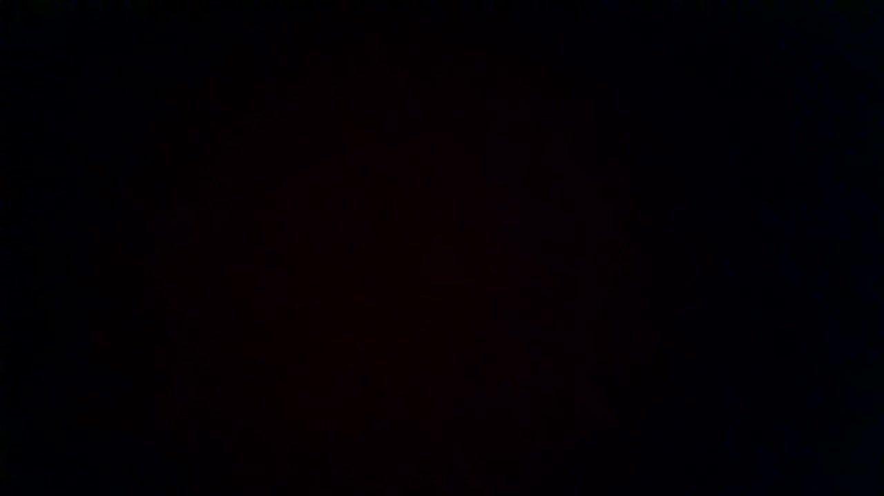 How was your post operative experience?