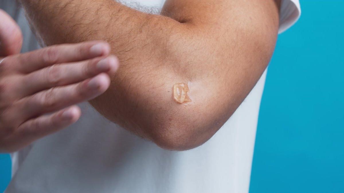 Man with elbow pain getting therapy massage with medicinal gel