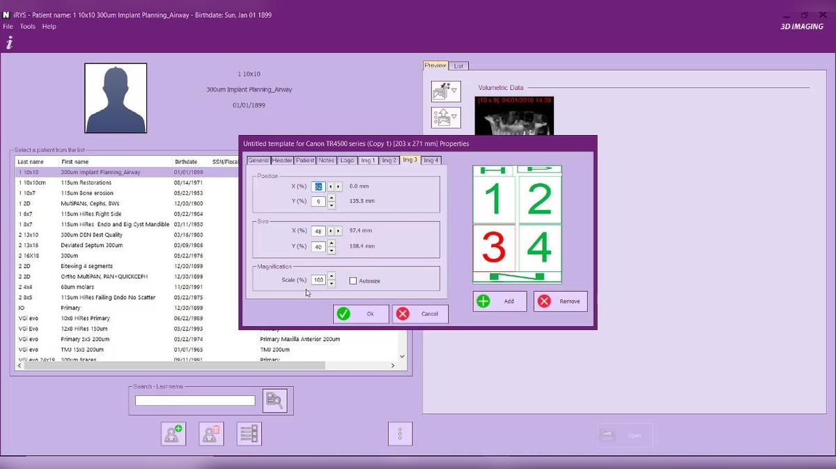 iRYS 11 Reports - Creating Reports Template