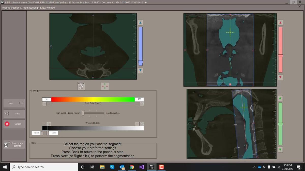 NNT 11 - Visualizing the Airway