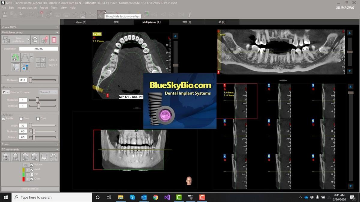 NNT 11 - One Click Blue Sky Integration