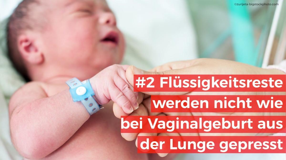 Pros und Contras bei einem Wunschkaiserschnitt