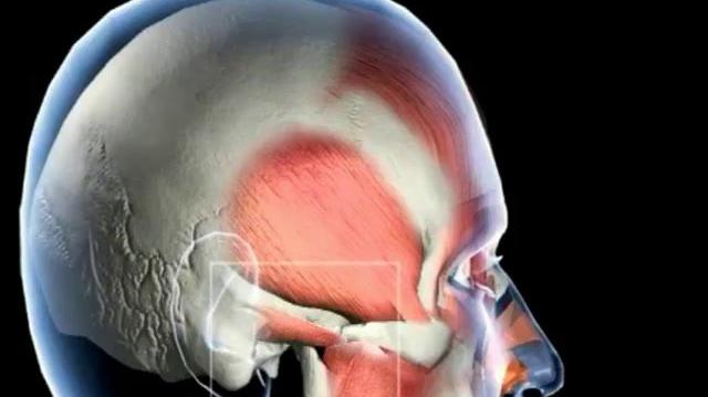 TMJ_-_Anterior_Disc_Displacement.mp4